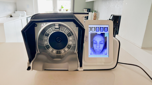 Real Results: 8 Weeks of LED Light Therapy with the SKINJOY LUMO Mask = 1-year reduction in measured skin age!