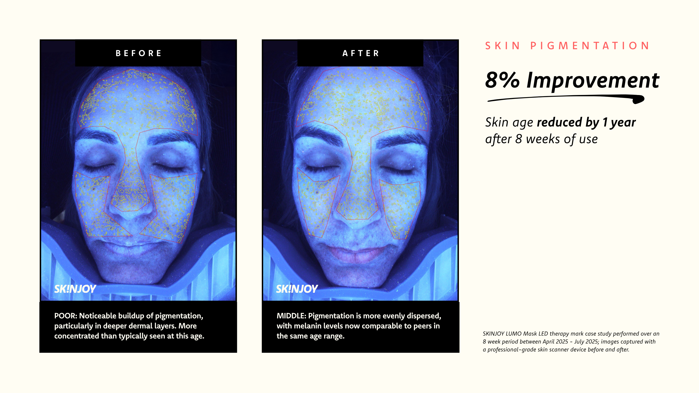 Improved skin metabolism in 8 weeks