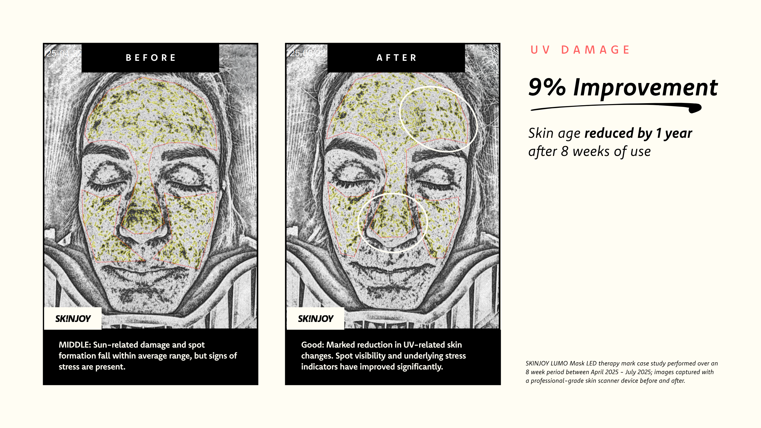 Improved skin metabolism in 8 weeks