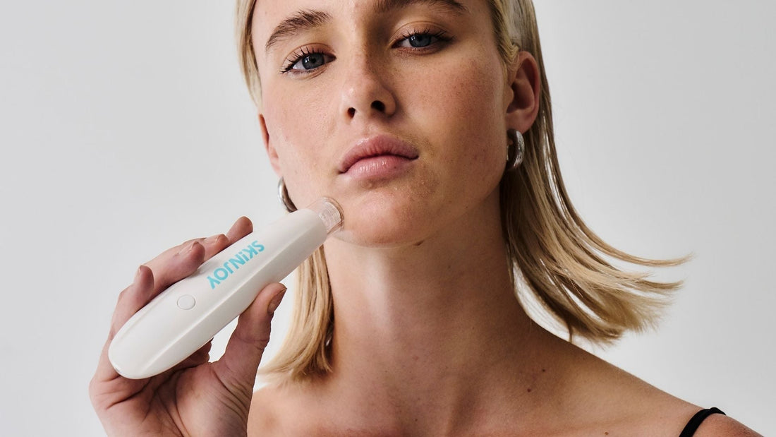 At What Age Can You Start At-Home Microneedling?
